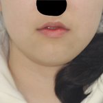 [댓글부탁해] 내 하관 어디가 <b>문제</b>냐ㅠ(사진<b>o</b>)