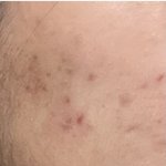 고3되고 <b>피부</b> <b>개</b>더러워짐..