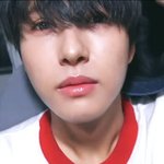 [모두드루와] <b>런쥔</b> 눈 붓기 적나라 한데 이걸