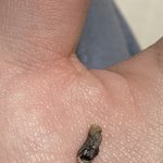 [댓글부탁해] 혐))) <b>배꼽때</b> ㄹㅈㄷ