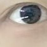 [댓글부탁해] 나 눈이 너무 다르게 생겼는데 <b>정상</b>이냐