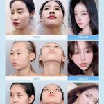 성형<b>수술</b> 다들 했나요??