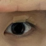 [<b>아자</b><b>아자</b>] 쌍커풀 만들기 1일차