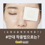 [댓글부탁해] <b>쌍수</b> 해본 애들 ㅈㅂ 들어와봐