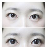 [댓글부탁해] 나 렌즈 끼고안까고 차이 딱 <b>이럼</b>