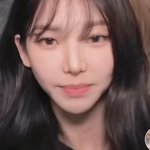 이게 카리나 코 <b>성형</b> 부작용인가?