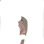 코수술하면 <b>비염</b>