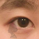 [댓글부탁해] 인라인에서 <b>세미</b>아웃으로 재수술 ㄱㄴ??