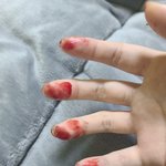 약혐) 입술 뜯는 <b>버릇</b> 어떻게 고치냐