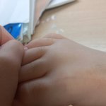 ㅇㄴ ㅅㅂ 나 여잔데 발가락에 털이 왜남..?