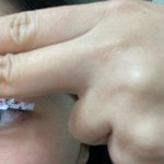 김판녀의 쌍커풀 만들기 1일차