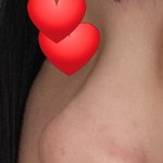 나 코수술 할건데 봐주라