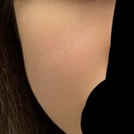 [댓글부탁해] 나 <b>홍조</b> 심한편이야??