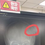 .(진행상황: CCTV확보, 경찰 고소장 접수, <b>CT</b>사진 있음)