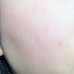 [뷰티톡] 피부에 좁쌀 <b>그득</b>했는데 개조아짐