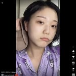 눈 주변 이렇게 <b>착색</b>된애들 있음?