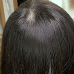 머리숱 적어<b>보임</b>?ㅜ