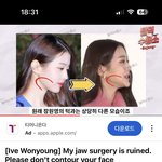 [엔터톡] 장원영 턱 코 이마<b>거상</b> 안함