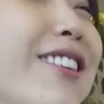 아이유 라미네이트 한거임??