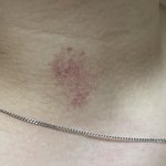 [댓글부탁해] 키스<b>마크</b> 남긴 적도 없는데 목에 키스<b>마크</b>