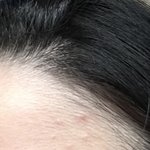 별모양으로 <b>트러블</b> <b>남</b>
