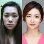 <b>왼쪽</b>같은 얼굴형은 뭘해야댐?