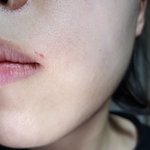 [꼭조언부탁] 치과 <b>의료</b>사고 도와주세요