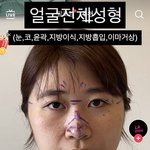 와 얼굴 전체 성형한거 차이 <b>보셈</b>