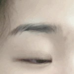 영상ㅇ)쌍수 재수술 후기 <b>n년차</b>