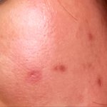 [이것좀봐줘] 천안 다가동 태평양 사우나 아줌마 딸래미 자살충 거머리...