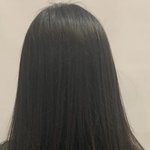 탈모였었을 때 머리숱 어때보임..?
