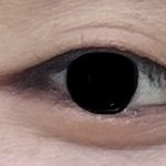 쌍수 상담,,