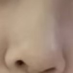 너네 내 코면 수술 할거야??