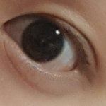 <b>쌍수</b> 한 눈 같음?