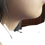 [댓글부탁해] <b>무턱</b>