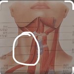 [드루와] <b>목</b> 이 <b>부분</b>이 자꾸 아픈데 왜 그럼