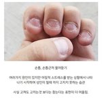 얘더라 이거 어게<b>고침</b> ㅈㅂ
