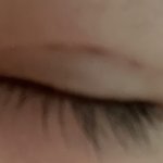 [댓글부탁해] <b>매몰</b>한지 삼주찬데 자국 ㅠㅠ