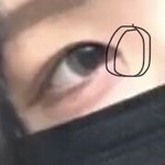 이거 앞트임하면 없어져??