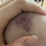 이거 <b>실핏줄</b> 터진거임??