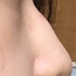 <b>코뼈</b> 중간에 튀어나온거