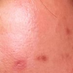 [댓글부탁해] 천안자살한년귀신붙은썰때밀이아줌마좀찾아주세요