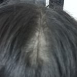[댓글부탁해] 다이어트 <b>탈모</b> 온듯