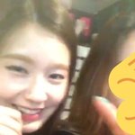 여자아이들 <b>미연</b> 코 성형전