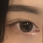 <b>쌍수</b> <b>티</b> 많이 남?