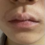 나 수염 완전 심해보이는데 어떡해.?.?.? 제발<b>제방</b>