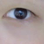 <b>무쌍</b>눈 쌍수