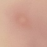 [댓글부탁해] 혐주)<b>코에</b> 이런거 낫는데 이거 어케없앰?