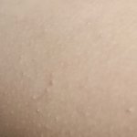 [꼭조언부탁] 다리에 이거 없애는 법 제발