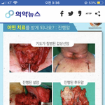 <b>네이버</b> 조카 빠꾸없네